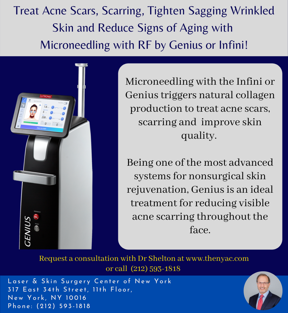 Microneedling with RF by Genius or Infini